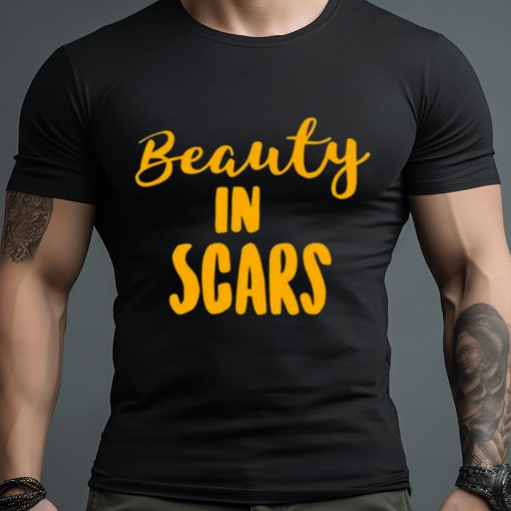 Original Beauty In Scars Shirt
